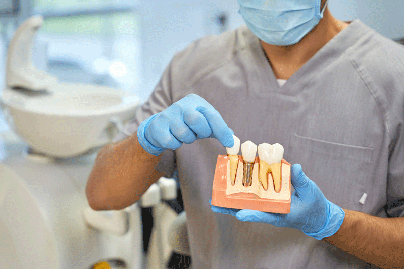 A dental doctor with a model of a dental implant in his handsA dental doctor with a model of a dental implant in his hands